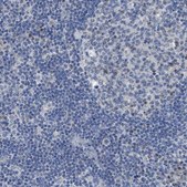 Anti-SFXN2 antibody produced in rabbit Prestige Antibodies&#174; Powered by Atlas Antibodies, affinity isolated antibody, buffered aqueous glycerol solution