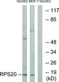 Anti-RPS20 antibody produced in rabbit affinity isolated antibody