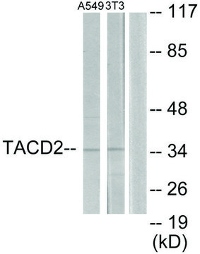 Anti-TACD2 antibody produced in rabbit affinity isolated antibody