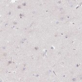 Anti-CRISP3 antibody produced in rabbit Prestige Antibodies&#174; Powered by Atlas Antibodies, affinity isolated antibody, buffered aqueous glycerol solution