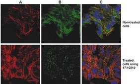 ProteoExtract&#174; Native Cytoskeleton Enrichment The ProteoExtract Native Cytoskeleton Enrichment &amp; Staining Kit provides cytoskeleton purification detergent buffers that retain focal adhesion &amp; actin-associated proteins while removing soluble cytoplasmic &amp; nuclear proteins from the cell.