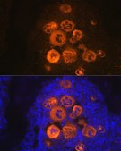 Anti-CXCL4/PF4 antibody produced in rabbit
