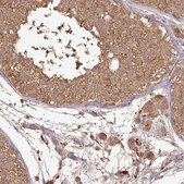 Anti-ATAT1 antibody produced in rabbit Prestige Antibodies&#174; Powered by Atlas Antibodies, affinity isolated antibody, buffered aqueous glycerol solution