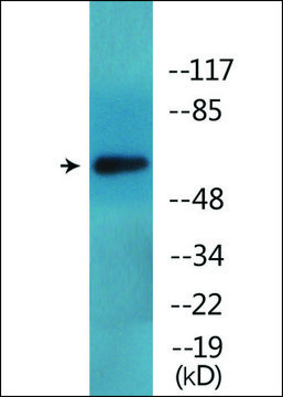 Anti-phospho-ICAM-1 (pTyr512) antibody produced in rabbit affinity isolated antibody