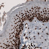 Monoclonal Anti-PARP1 Prestige Antibodies&#174; Powered by Atlas Antibodies, clone CL2209, purified immunoglobulin, buffered aqueous glycerol solution