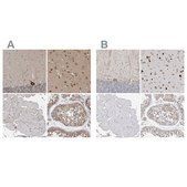 Anti-ATXN2 antibody produced in rabbit Prestige Antibodies&#174; Powered by Atlas Antibodies, affinity isolated antibody, buffered aqueous glycerol solution, Ab2