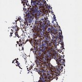 Anti-TYROBP antibody produced in rabbit Prestige Antibodies&#174; Powered by Atlas Antibodies, affinity isolated antibody, buffered aqueous glycerol solution