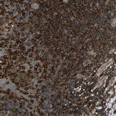 Anti-TLN1 antibody produced in rabbit Prestige Antibodies&#174; Powered by Atlas Antibodies, affinity isolated antibody, buffered aqueous glycerol solution