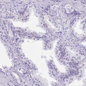 Anti-LRRC18 antibody produced in rabbit Prestige Antibodies&#174; Powered by Atlas Antibodies, affinity isolated antibody, buffered aqueous glycerol solution