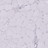 Anti-SLC6A1 antibody produced in rabbit Prestige Antibodies&#174; Powered by Atlas Antibodies, affinity isolated antibody, buffered aqueous glycerol solution