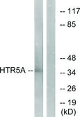 Anti-HTR5A antibody produced in rabbit affinity isolated antibody