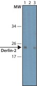 Anti-Derlin-2 antibody produced in rabbit ~1.0&#160;mg/mL, affinity isolated antibody, buffered aqueous solution