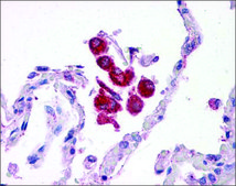 Anti-TLR2 affinity isolated antibody