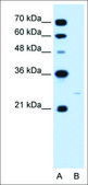 Anti-MXI1 antibody produced in rabbit affinity isolated antibody