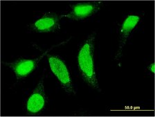 Monoclonal Anti-CSNK1D, (C-terminal) antibody produced in mouse clone 4H8, purified immunoglobulin, buffered aqueous solution
