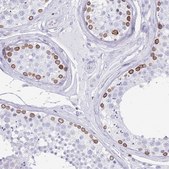 Anti-LBR antibody produced in rabbit Prestige Antibodies&#174; Powered by Atlas Antibodies, affinity isolated antibody, buffered aqueous glycerol solution