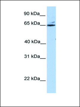 Anti-GPT2 antibody produced in rabbit affinity isolated antibody