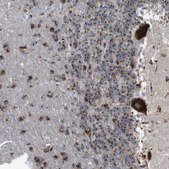 Anti-TGOLN2 antibody produced in rabbit Prestige Antibodies&#174; Powered by Atlas Antibodies, affinity isolated antibody, buffered aqueous glycerol solution