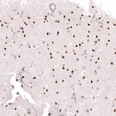 Monoclonal Anti-Bcl11A Antibody Produced In Mouse Prestige Antibodies&#174; Powered by Atlas Antibodies, clone CL13530, affinity isolated antibody, buffered aqueous glycerol solution