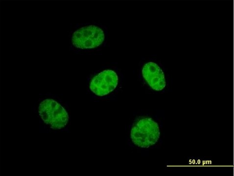 Anti-KBTBD9 antibody produced in mouse purified immunoglobulin, buffered aqueous solution