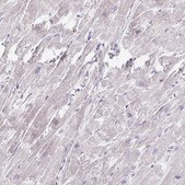 Anti-MYLK2 antibody produced in rabbit Prestige Antibodies&#174; Powered by Atlas Antibodies, affinity isolated antibody, buffered aqueous glycerol solution