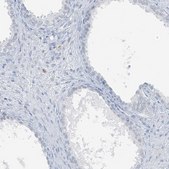 Anti-SCML1 antibody produced in rabbit Prestige Antibodies&#174; Powered by Atlas Antibodies, affinity isolated antibody, buffered aqueous glycerol solution