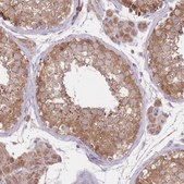 Anti-PREP antibody produced in rabbit Prestige Antibodies&#174; Powered by Atlas Antibodies, affinity isolated antibody, buffered aqueous glycerol solution