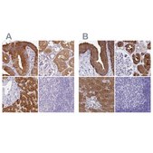 Anti-HGD antibody produced in rabbit Prestige Antibodies&#174; Powered by Atlas Antibodies, affinity isolated antibody, buffered aqueous glycerol solution