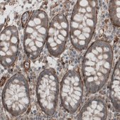 Monoclonal Anti-LAMB2 antibody produced in mouse Prestige Antibodies&#174; Powered by Atlas Antibodies, clone CL2976, purified immunoglobulin, buffered aqueous glycerol solution