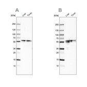 Anti-FGB antibody produced in rabbit Ab2, Prestige Antibodies&#174; Powered by Atlas Antibodies, affinity isolated antibody, buffered aqueous glycerol solution