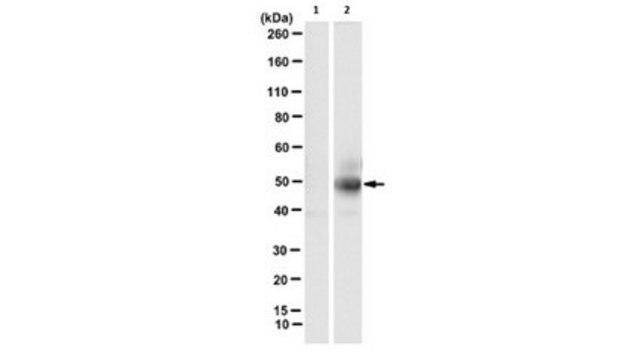 Anti-phospho-cytokeratin-18 (K18) (Ser33) Antibody, clone IB4 clone IB4, from mouse