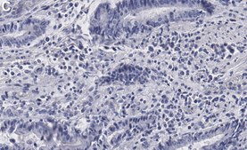 Anti-p-RPS6 (Ser240/244) Antibody, clone 2H10 ZooMAb&#174; Rabbit Monoclonal recombinant, expressed in HEK 293 cells