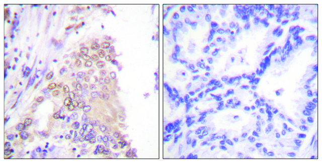 Anti-AML1 antibody produced in rabbit affinity isolated antibody