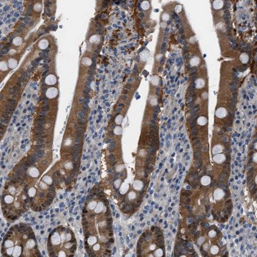 Anti-TMEM45B antibody produced in rabbit Prestige Antibodies&#174; Powered by Atlas Antibodies, affinity isolated antibody, buffered aqueous glycerol solution