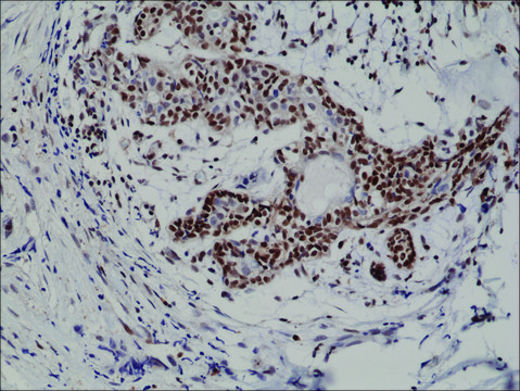 Anti-p27Kip1antibody, Rabbit Monoclonal recombinant, expressed in HEK 293 cells, clone RM302, purified immunoglobulin