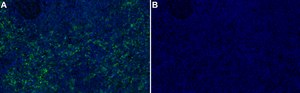 Anti-ERK5 Antibody, clone 2H15 ZooMAb&#174; Rabbit Monoclonal recombinant, expressed in HEK 293 cells