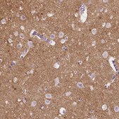 Anti-NCAN antibody produced in rabbit Prestige Antibodies&#174; Powered by Atlas Antibodies, affinity isolated antibody, buffered aqueous glycerol solution