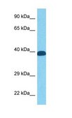 Anti-FOS antibody produced in rabbit affinity isolated antibody
