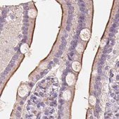 Anti-TREH antibody produced in rabbit Prestige Antibodies&#174; Powered by Atlas Antibodies, affinity isolated antibody, buffered aqueous glycerol solution