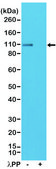 Anti-Phospho-AMPA Receptor antibody, GluR 1 subunit (Ser845), Rabbit Monoclonal recombinant, expressed in HEK 293 cells, clone RM296, purified immunoglobulin