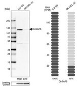 Anti-DLGAP5 antibody produced in rabbit Prestige Antibodies&#174; Powered by Atlas Antibodies, affinity isolated antibody, buffered aqueous glycerol solution