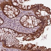Anti-SRI antibody produced in rabbit Prestige Antibodies&#174; Powered by Atlas Antibodies, affinity isolated antibody