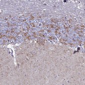 Anti-GAD2 antibody produced in rabbit Prestige Antibodies&#174; Powered by Atlas Antibodies, affinity isolated antibody, buffered aqueous glycerol solution