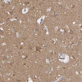 Anti-CAMK2D antibody produced in rabbit Prestige Antibodies&#174; Powered by Atlas Antibodies, affinity isolated antibody, buffered aqueous glycerol solution