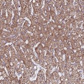Anti-EI24 antibody produced in rabbit Prestige Antibodies&#174; Powered by Atlas Antibodies, affinity isolated antibody, buffered aqueous glycerol solution