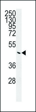 ANTI-G6PC (CENTER) antibody produced in rabbit IgG fraction of antiserum, buffered aqueous solution