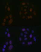 Anti-ALOX5 antibody produced in rabbit