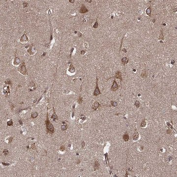 Anti-AGPAT1 antibody produced in rabbit Prestige Antibodies&#174; Powered by Atlas Antibodies, affinity isolated antibody