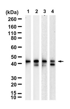 Anti-CKII-&#945; Antibody, clone 3K8 ZooMAb&#174; Rabbit Monoclonal recombinant, expressed in HEK 293 cells