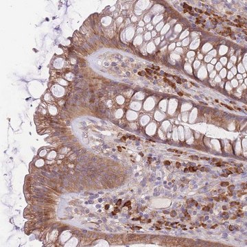 Anti-BEX2 antibody produced in rabbit Prestige Antibodies&#174; Powered by Atlas Antibodies, affinity isolated antibody, buffered aqueous glycerol solution